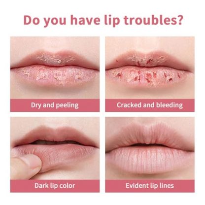 Dual Pack Honey-Tinted Hydrating Lip Balm in Black Cherry Shades - Image 7